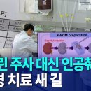 "인슐린 주사 대신 인공췌장"..당뇨병 치료 새 길｜ TJB 대전·세종·충남뉴스 이미지