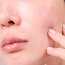 피부 필수템 올영세일 꼭 챙겨야할 추천제품 브링그린 징크테카 트러블 세럼 + 알로에 수딩 젤, 티트리...