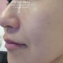 예쁜여우피부관리 이미지