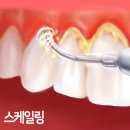 서울힐스치과의원 이미지