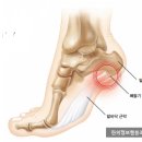 이훈구한의원 네이버블로그