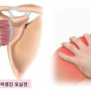리메디PT 이미지