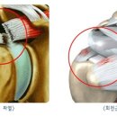 [강남어깨통증클리닉-회절근개질환]어깨 통증의 90%원인 '회절근 개 질환이란'?- 연세사랑병원 이미지