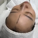 송도피부관리 고민 끝! 라일라뷰티 스킨플래닝 만족 후기