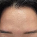 미앤미 의원 | 울산 삼산 미앤미의원 보톡스 후기