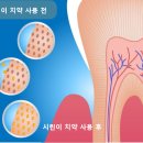 상아치과의원 | 지산동 치과, 시린이 치약, 정말 효과가 있는 걸까요?