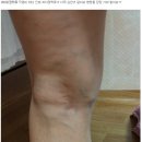 아나파적맥통증의원 이미지