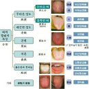 혀로 알아보는 건강법~! 이미지