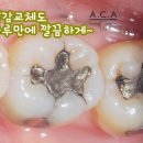 에이블치과기공소 이미지