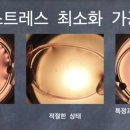 아이필 안경원 이미지