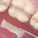 이룸치과기공소 이미지