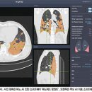 수메디테크 이미지
