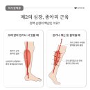 평택순환관리 추천, 하체가 가벼워지는 밀도뷰티랩 후기