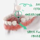 본기공소 네이버블로그