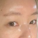 청라 여드름 에스테틱더함 에서 피부 홍조 관리