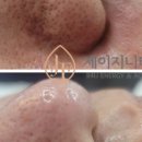 제이테라피 이미지