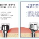 덴티움기공소 이미지