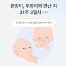 금가위머리사랑 | [임신 31주] 쌍둥이 임신 후기 증상, 초음파, 몸무게, 머리크기, 배둘레, 쌍둥이 성장차이