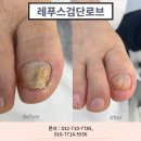 레푸스검단로브