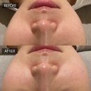 동래럭키약국 | 부산동래안락동여드름관리 흉터없는 압출 전문 | 동래에스테틱 | 레오아에스테틱 부산본점