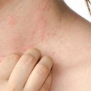 설한의원 이미지