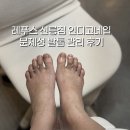 매료네일 문제성전문점 | 선릉역 문제성 발톱 전문점, 레푸스 선릉점 인디고네일 관리 후기(비포/애프터)