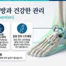 송파원정형외과의원 네이버블로그
