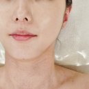 새솔유치원 | 전주 에코시티 피부관리 스마일에스테틱 후기