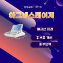대구아그네스 레이저로 해야하는 경우 동대구에스미의원 박나연 원장