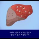 ☆★☆★ 간경화증 ☆★☆★ 이미지