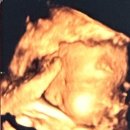 11620-전25-36-3 | 임신 후기 이야기 - 임신 34주, 임신 35주, 임신 36주 그리고 임신 37주 출산예정