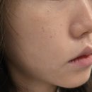 한국줄기세포 | 킴 카다시안이 내한해서 받은 10년 젊어진다는 줄기세포주사 직접 맞아본 후기 (전후사진)