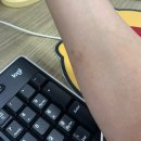 다나은요양병원 | 4월 : 팔뚝 대상포진 걸렸다 나은 후기