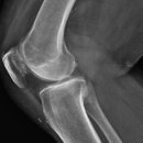 미사좋은하루정형외과의원 이미지