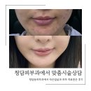 더안청담의원 | 청담 소프웨이브 플라즈망 리프팅시술 청담 피부과후기 내돈내산