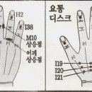 수지침 이미지