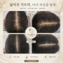 도노포레스타 두피케어(산본점)