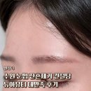 대만족 | 수원 눈썹 잔흔제거 컨설팅 잘하는 뉴아뷰티 대만족 후기
