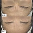 벌곡로 | 대전 신부관리 후기 피부결부터 윤곽까지 루모어뷰티끄