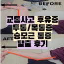 모션리햅 | 교통사고 후유증 목/어깨 통증, 근육경직과 신경을 이완해 보세요! 최00님 후기