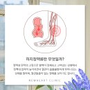 뉴하트의원 | 해운대하지정맥류 수술회복 주의사항