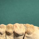 설 치과기공소 이미지