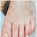 역삼-1335 | 강남에서 발견한 발 관리 전문 공간, 네오네일 하이푸스 역삼점에서 경험한 내성발톱 문제성발톱 케어 후기