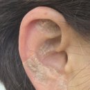 통합건강관리실 | 압구정 피부관리실 이지에스테틱, 이혈 테라피로 만나는 피부·건강 관리의 비밀