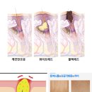 베카로움 이미지