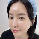 천하무적인테리어 | 악센다 마호로사 미스트 물광피부 공구 템 추천 내돈내산 후기 2+1 할인