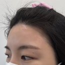 아름헤어라인 - 성남시 수정구 | 아름헤어라인