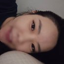 또또살롱 | 내돈내산 절개헤어라인 모발이식 비포/애프터 후기(+다야살롱속눈썹연장)