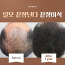 글로웰의원 티스토리