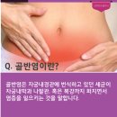 제니산부인과의원 네이버블로그